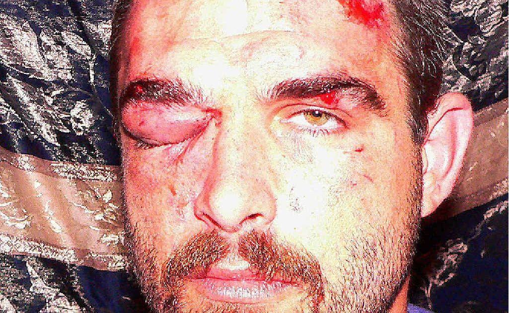 Timothy Braeckmans was bashed by two men at PubFest last year. Timothy Braeckmans was bashed by two men at PubFest last year.
